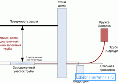 Le schéma d'utilisation de la coupe Esmarch Le schéma d'utilisation de la coupe Esmarch